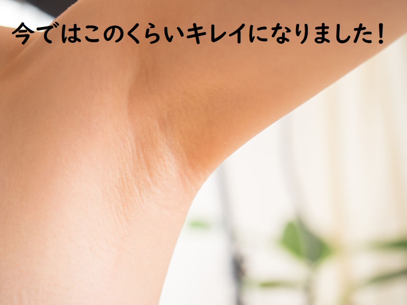 美白に関する注意事項